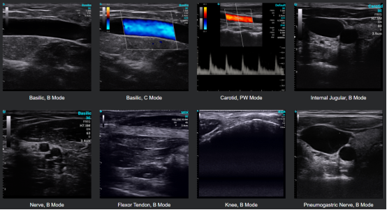 手持式超声波准确吗？