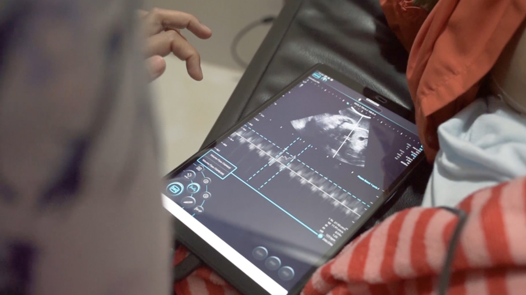 SonoEye 故事 | SonoEye 与印度尼西亚助产士的旅程