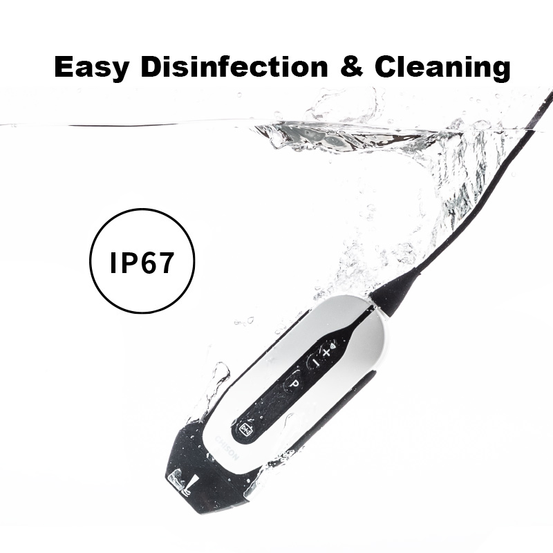 手持式超声 SonoEye P1