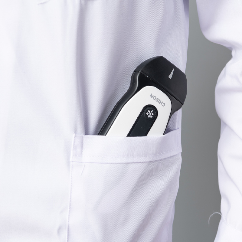 手持式超声波SonoEye P1