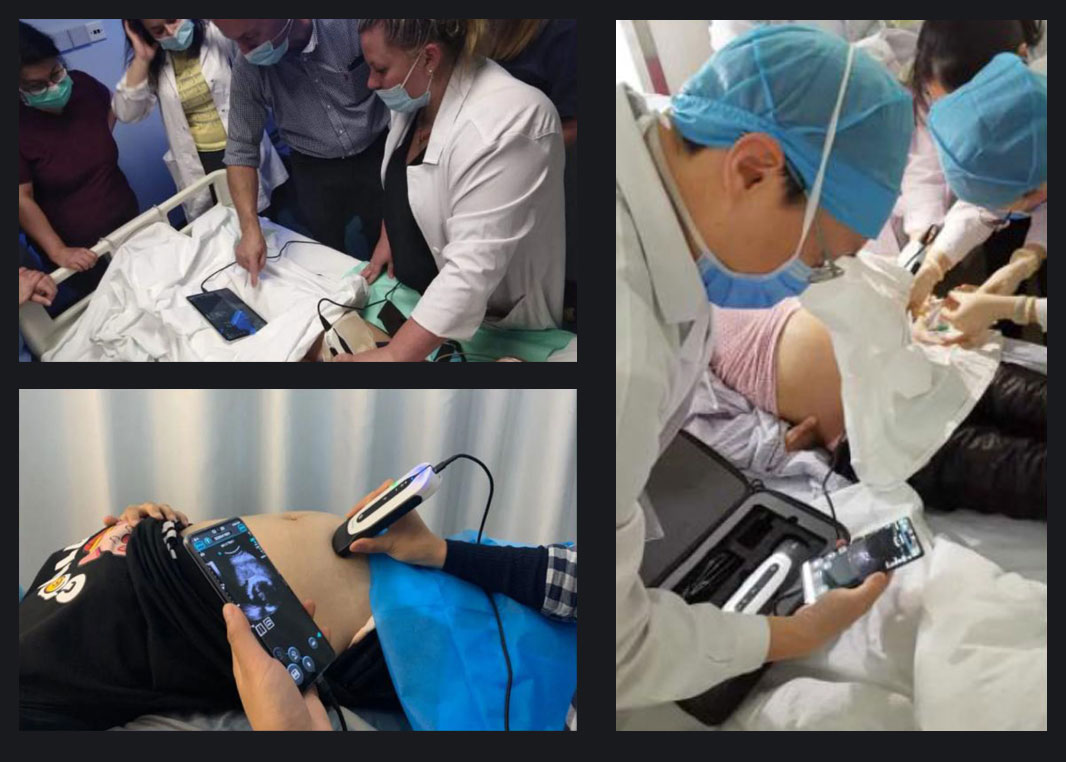 CHISON SonoEye 的愿景是增强女性健康。