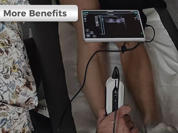 为什么您需要手持式超声检查