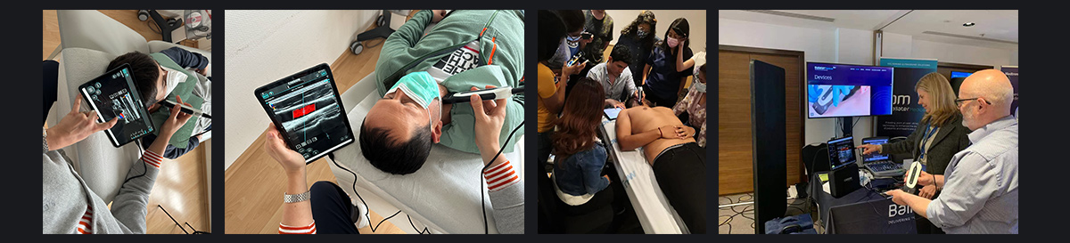 SonoEye 在血管超声中的应用