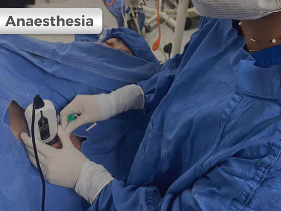 麻醉中的 SonoEye