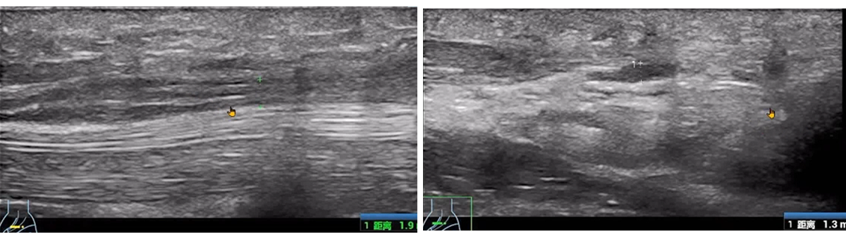 Case Studies in Wrist Ultrasound