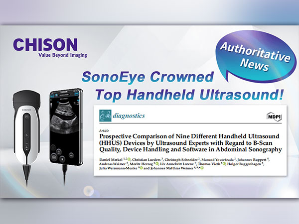 Authoritative Findings: SonoEye Hailed as Premier Ultrasound Device