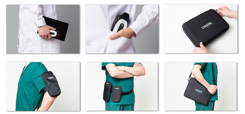 Authoritative Findings: SonoEye Hailed as Premier Ultrasound Device