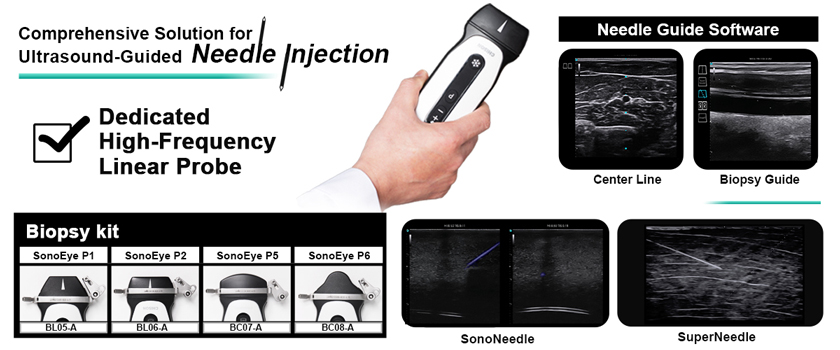 Mastering SonoEye: A Beginner's Guide to Portable Handheld Ultrasound for Clinical Efficiency
